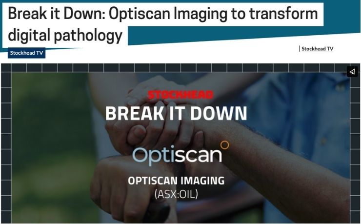 Optiscan graphics