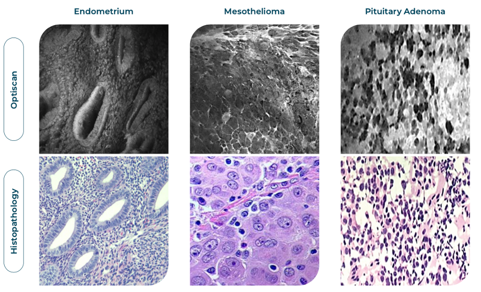 Future of pathology article image